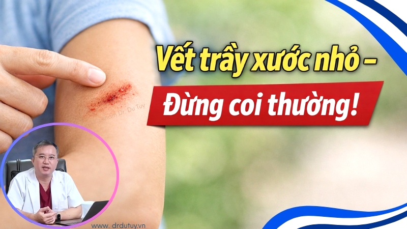 Chủ quan với các vết trầy xước nhỏ – Nguyên nhân âm thầm dẫn đến hoại tử nguy hiểm