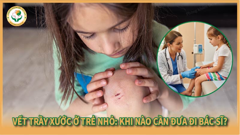 Vết trầy xước ở trẻ nhỏ: Khi nào cần đưa đi bác sĩ?