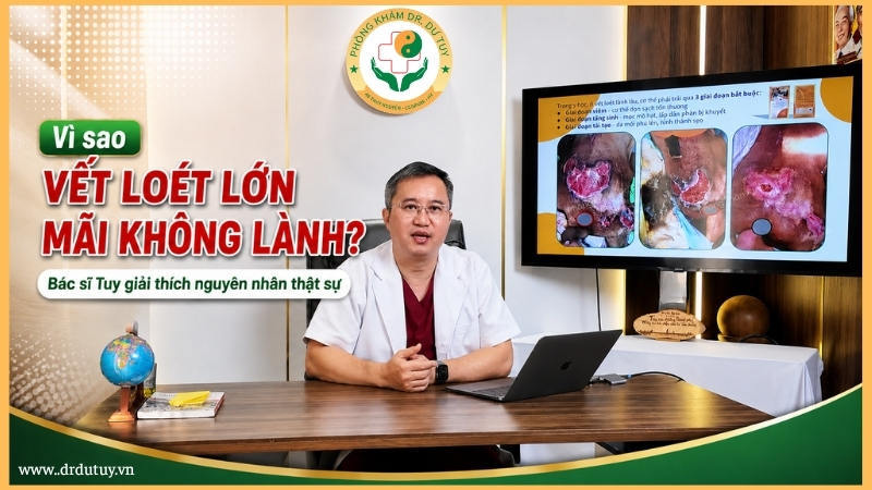 vì sao vết loét lớn mãi lâu lành