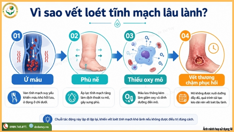 vì sao vết loét tĩnh mạch lâu lành