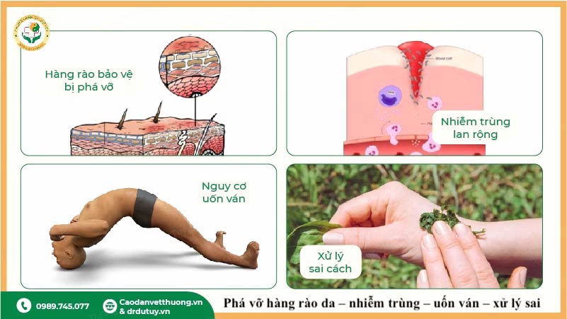 vì sao vết trầy xước nhỏ gây hoại tử
