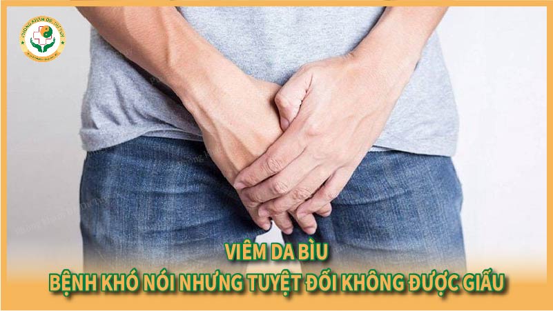 Viêm da bìu: Bệnh khó nói nhưng tuyệt đối không được giấu