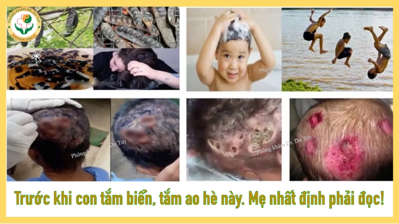 Trước khi cho con tắm biển hay tắm ao hè này, mẹ nhất định phải đọc!