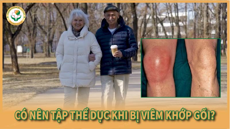 viêm sưng đau tràn dịch khớp gối