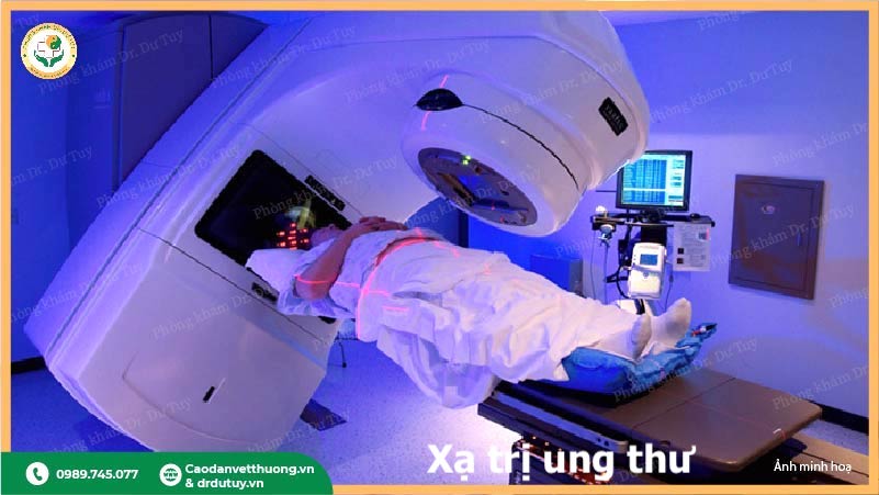 xạ trị điều trị ung thư vòm họng imrt vmat