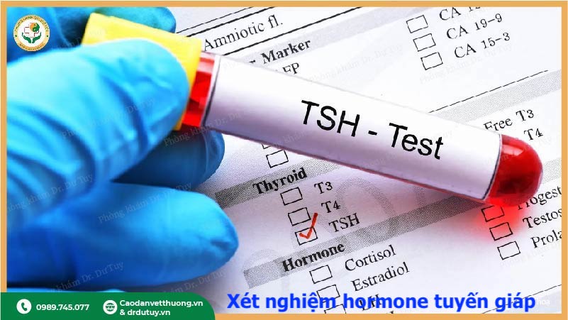 xét nghiệm tsh hormone tuyến giáp chẩn đoán ung thư