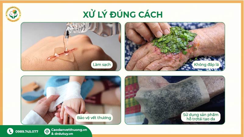 xử lý đúng cách khi bị trầy xước da