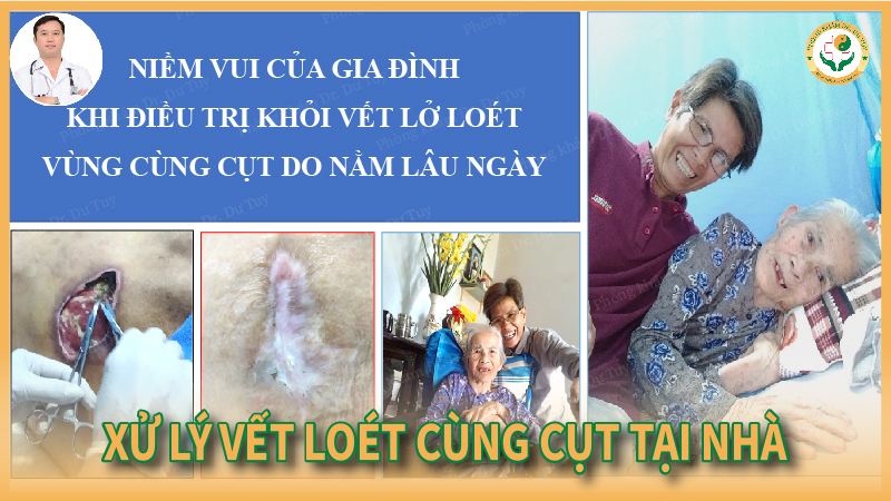 Xử lý vết loét vùng cùng cụt tại nhà và giải pháp hiệu quả với Cao dán Dr. Dư Tuy