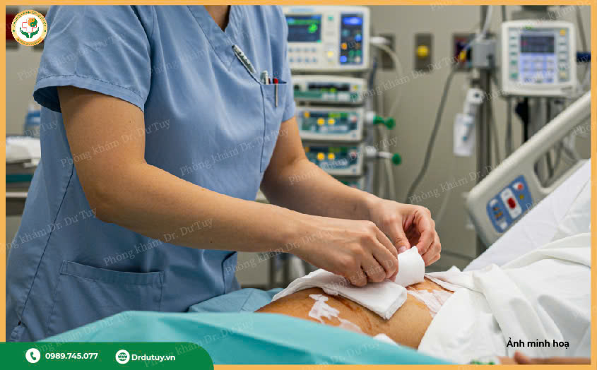 xử lý vết loét vùng cùng cụt