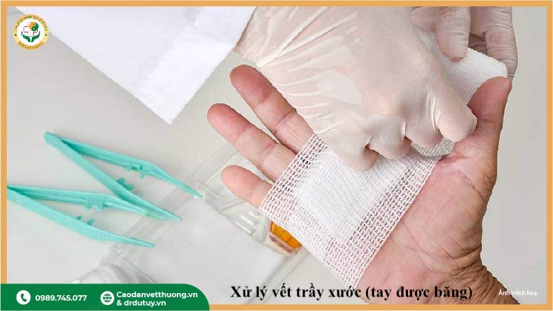 xử lý vết trầy xước ngoài da tại nhà